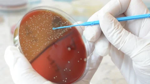Laboratory doctor using inoculation loop to isolate Staphylococcus bacteria Stock-Footage 59736940