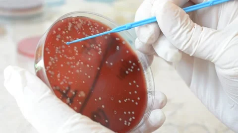 Laboratory doctor using inoculation loop to isolate Escherichia coli bacteria Stock Footage 59736944