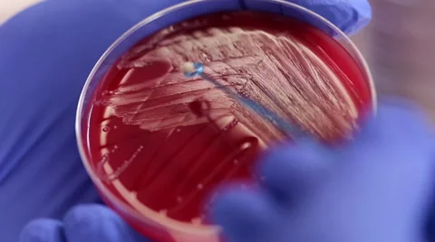 Laboratory Investigation 動画素材 31548736