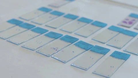 Laboratory microscope samples on a glass slide 4k Video stock 82743314