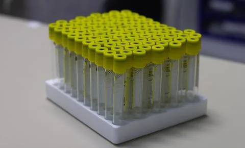 The laboratory prepared test tubes for taking blood tests. In the medical center Stock Photos