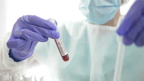 Laboratory sample of blood testing for diagnosis coronavirus infection in the Stock Footage 129387117