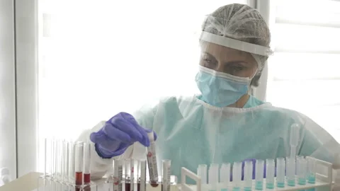Laboratory sample of blood testing for diagnosis coronavirus infection in the Stock Footage 130069118