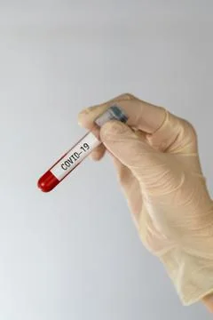 Laboratory sample of blood testing for diagnosis new Corona virus infection Stock Photos