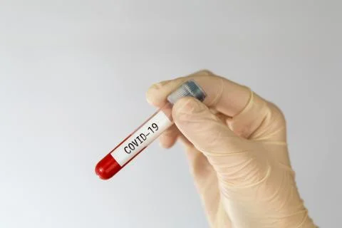 Laboratory sample of blood testing for diagnosis new Corona virus infection Stock Photos