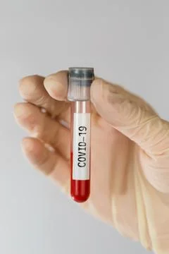 Laboratory sample of blood testing for diagnosis new Corona virus infection Stock Photos
