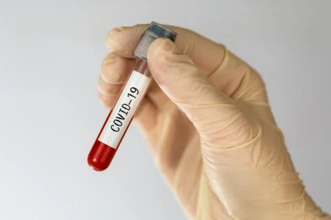 Laboratory sample of blood testing for diagnosis new Corona virus infection Stock Photos