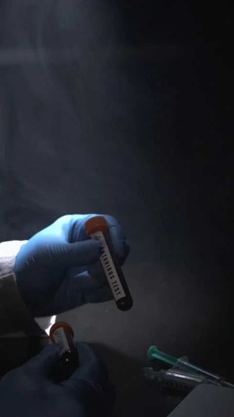Laboratory Sample Handling. Hands Sorting Labeled Vials On Dark Surface Accurate Stock Footage 335579321