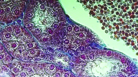 Laboratory sample under a microscope Stock Footage 73387595