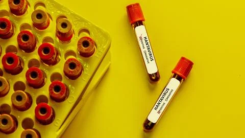 Laboratory samples show hantavirus testing in a scientific research setting Stock Photos