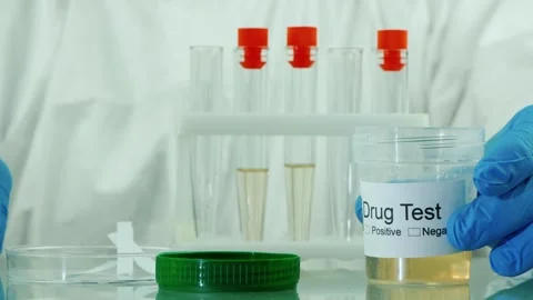 Laboratory scientist performing drug test analysis using urine sample in me.. Stock Footage 334543200