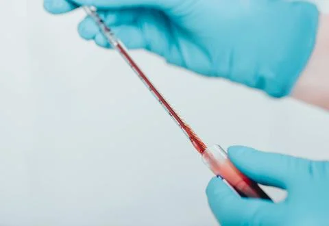 Laboratory scientist working with blood sample , close-up.Blood research Stock Photos