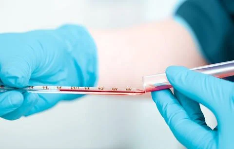 Laboratory scientist working with blood sample , close-up.Blood research Foto stock