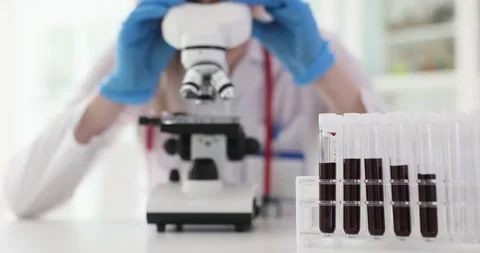 Laboratory technician analyzes blood samples using a microscope in a medical lab Stock Footage 284201313