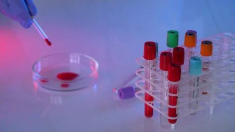 Laboratory technician dripping blood sample into petri dish for clinical te.. Stock Footage 337633556