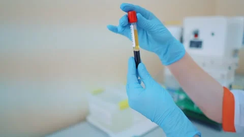 Laboratory technician holding test tube with separated blood plasma and red.. Stock Footage 337548351