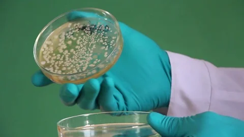 Laboratory technician opens the petri dish coated with bacterial colonies Stock Footage 73170700