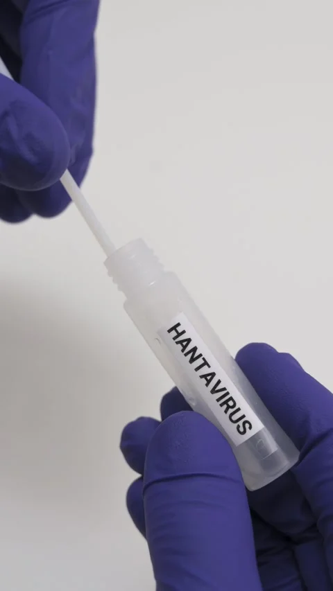 Laboratory technician performing hantavirus diagnostic test with swab sample Stockbeeldmateriaal 334602337