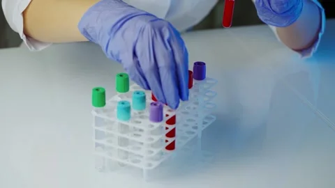 Laboratory technician placing blood sample tubes into medical rack for diag.. Stock Footage 337682761