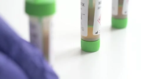 Laboratory technician preparing fecal occult blood tests 库存影片 336733535