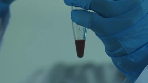 A laboratory technician in a white coat and protective gloves pours liquid into Stock Footage 271235705