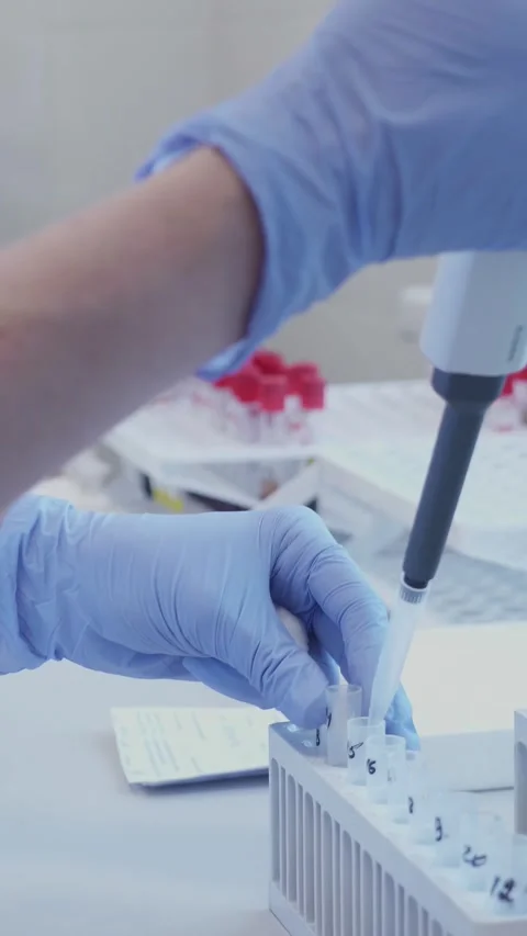 Laboratory Techniques Specifically Designed for Precise Pipetting and Sample Stock Footage 313732699