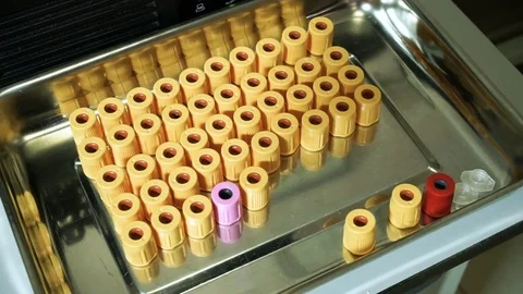 Laboratory test of blood. Close-up of rubber caps for glass retorts on a tray HD Stock Footage 72391053