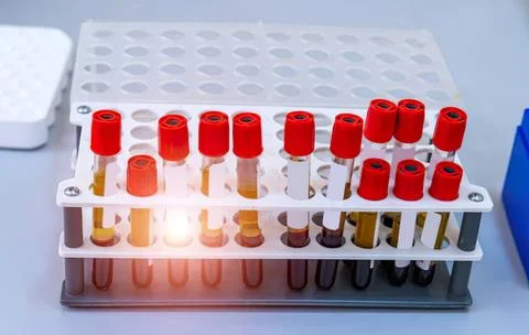 Laboratory test tubes with blood samples in a rack Stock Photos
