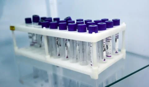 Laboratory. Test tubes in a stand on the table. Stock Photos