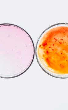 Laboratory testing for bacterial infection Stock Photos