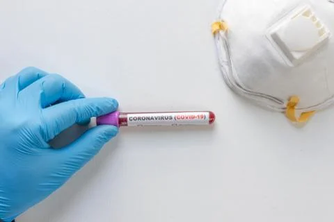 Laboratory testing patients blood samples for presence of coronavirus (COVID- 写真素材
