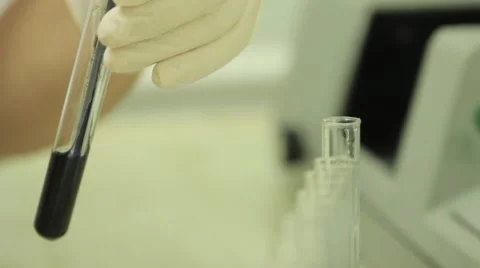 Laboratory test.mp4 Stock Footage 45415347