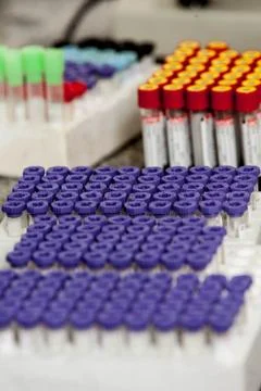 Laboratory tubes Stock Photos