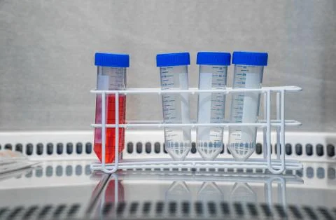 Laboratory work. Tubes for cell splitting at the sterile bank. Stock Photos