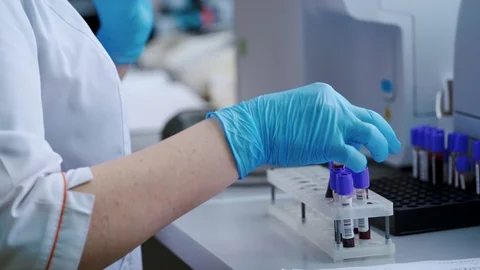 Laboratory worker with blood samples. Woman's hands in sterile gloves working Video stock 120982702