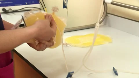 Laboratory worker examines a packet of plasma. Transfusion Center. Video noise. Stock Footage 148148623