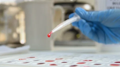 Laboratory worker holds cuvette for definition of blood type and Rh factor. Stock Footage 98004717