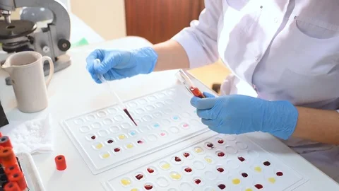 Laboratory worker holds cuvette for definition of blood type and Rh factor. Stock Footage 98005107