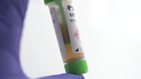 Laboratory worker shaking stool sample test tube Stock Footage 336733583