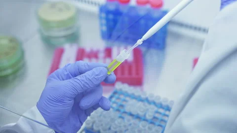 Laboratory worker takes sample of yellow liquid from test tube with automatic Stock Footage 158792874