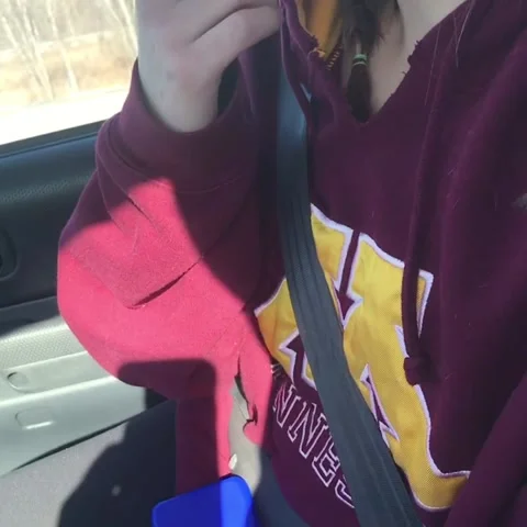 Lady is Loopy After Oral Surgery, Stock Video Pond5