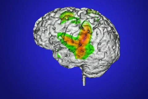  Language study Three-dimensional image of the brain, calculated on the ba... Foto stock