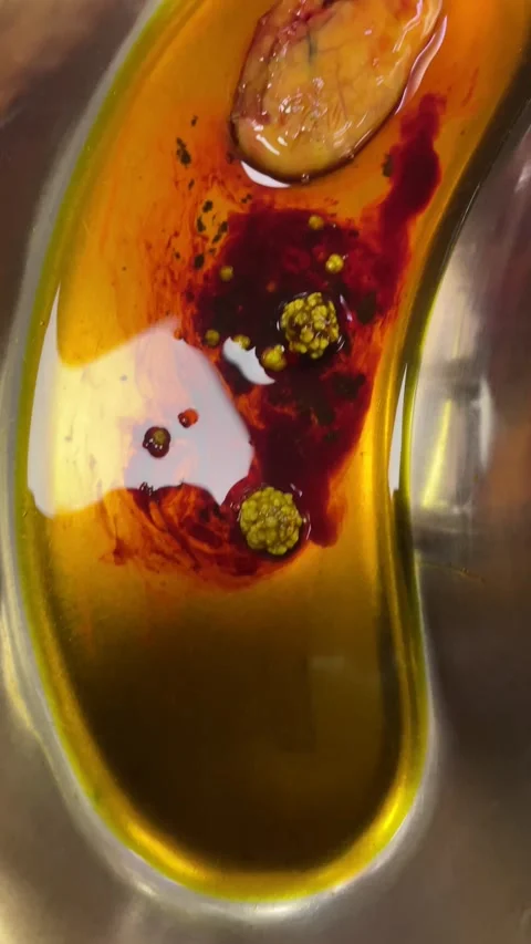 Laparoscopic cholecystectomy Stock Footage 253502242