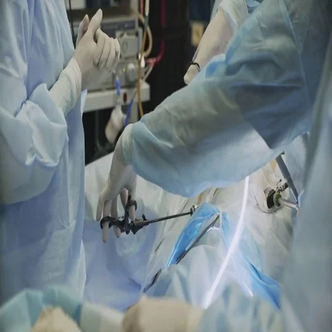 Laparoscopic cholecystectomy it mean Gallbladder Surgery Stock Footage 69420130