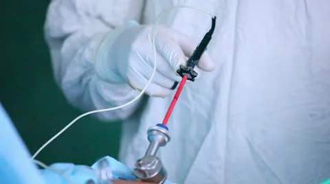 Laparoscopic surgery of the abdomen 3 스톡 동영상 21944602