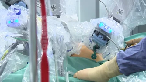 Laparoscopic surgery of the abdomen. Doctor's hands in glove. Stock Footage 148904230
