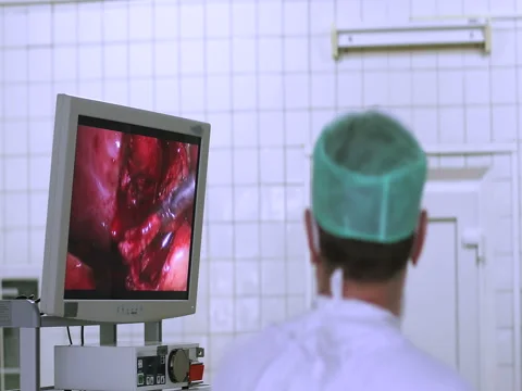 Laparoscopic surgery of the abdomen. Stock Footage 73884134