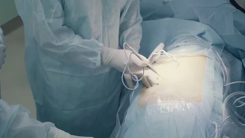 Before laparoscopic surgery of the abdomen 動画素材 74764649