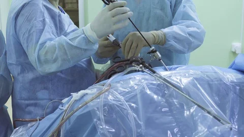 Laparoscopic surgery of the abdomen Stock Footage 88633384