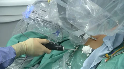 Laparoscopic surgery. Doctor's hand in glove. Close up. Stock Footage 148148661
